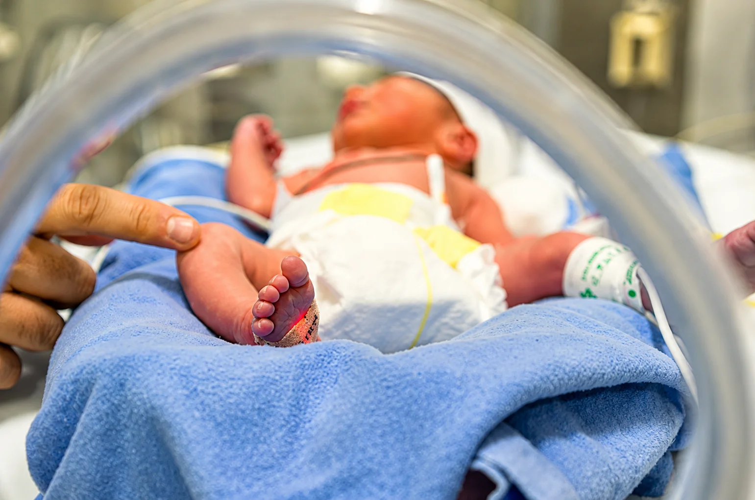 Newborn infant receiving neonatal care in a hospital incubator with glucose monitoring.