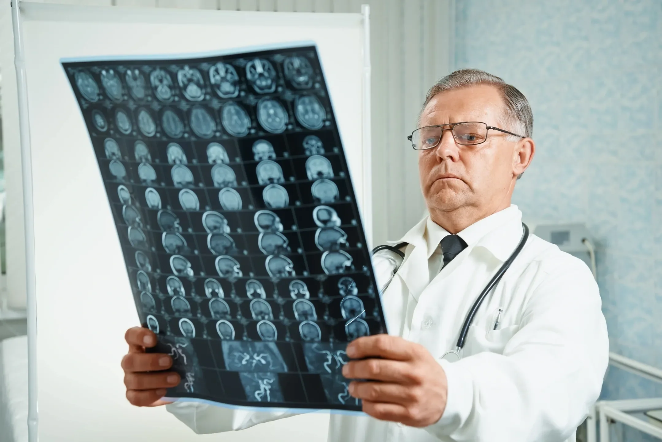 Physician examining a brain scan